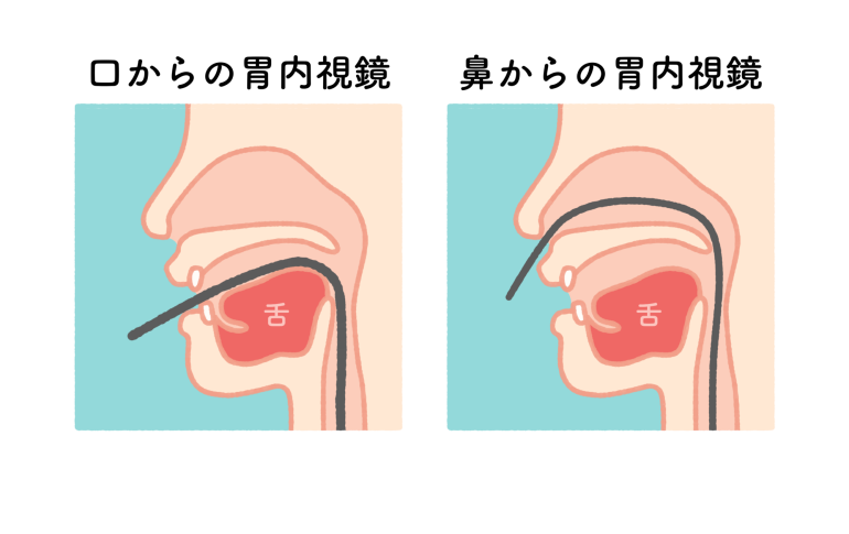 経鼻内視鏡